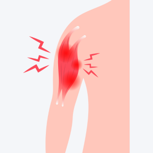 Muscle Spasm Physiotherapy Treatment – Effective Relief at Dr. Soumya’s Physiotherapy and Rehab Clinic