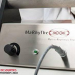 Matrix Rhythm Therapy at Dr. Soumya's Physiotherapy Clinic